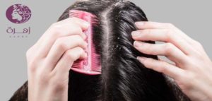 أسهل 4 طرق للتخلص من قشرة الشعر