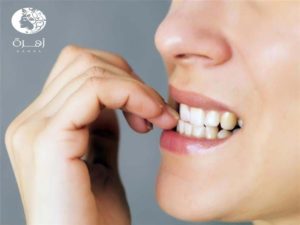 أفضل 6 طرق للتخلص من قضم الأظافر